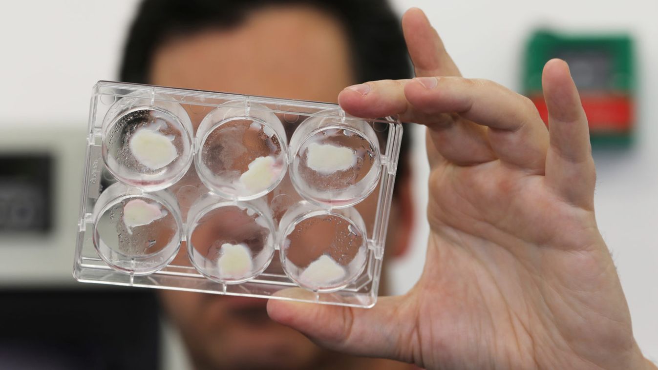 Yaakov Nahmias, founder and chief scientist of Future Meat Technologies, holds laboratory-grown fat samples in his lab in Jerusalem