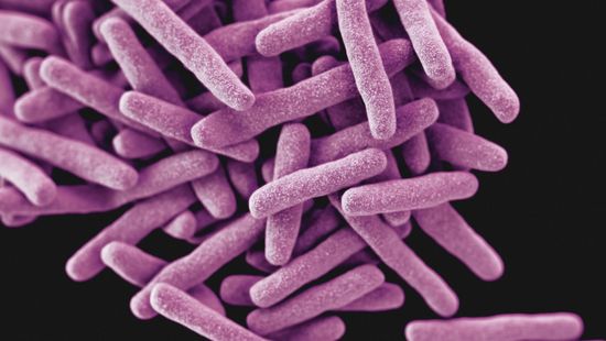 A világ leggyakrabb halálokai között vannak az antibiotikum-rezisztens kórokozók