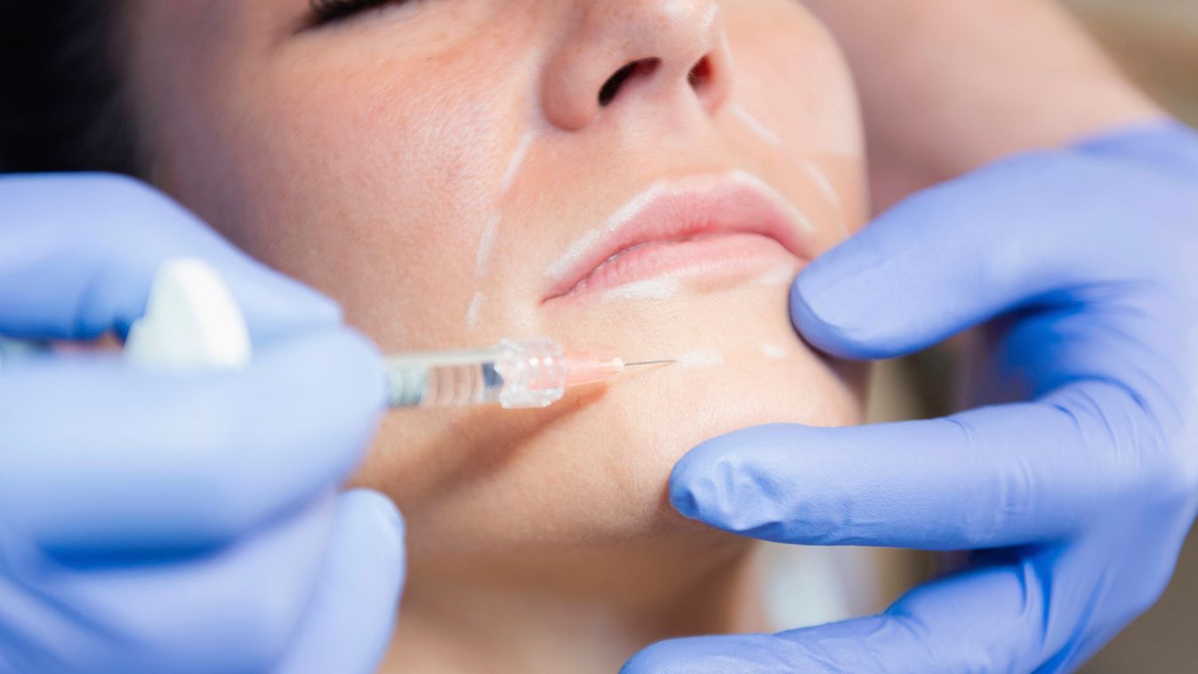 Woman having hyaluronic acid injections