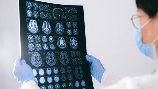 Magyar kutatók felfedezése segíthet megérteni a Parkinson-kórt és a skizofréniát