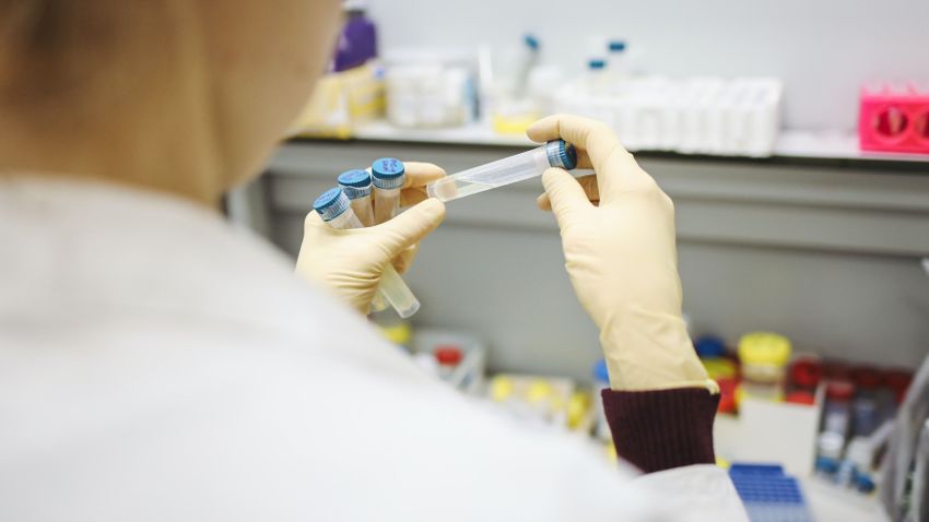 Már a kínaiak sem zárják ki, hogy laboratóriumi szivárgás is okozhatta a Covid-járványt Már a kínaiak sem zárják ki, hogy laboratóriumi szivárgás is okozhatta a Covid-járványt