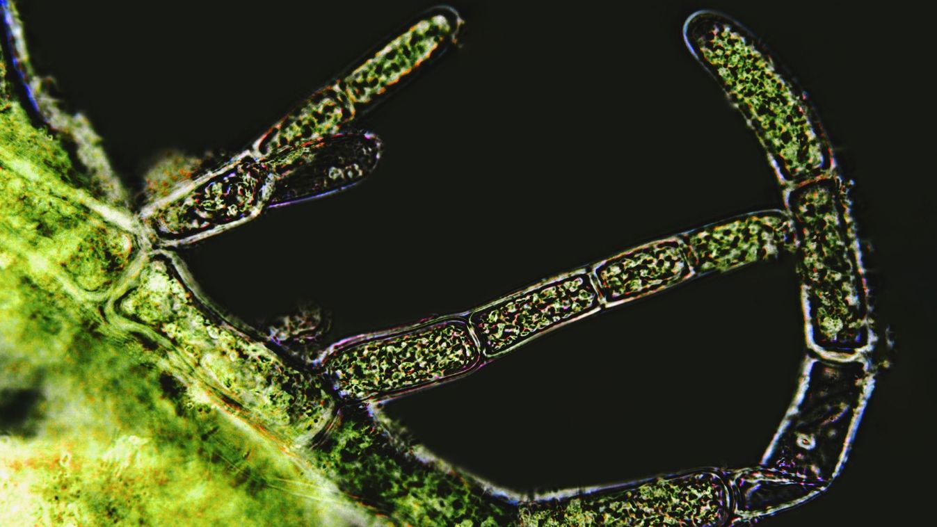Cladophora,Sp.,Algae,Under,Microscopic,View,,Filamentous,Green,Algae,,Dark
ostreopsis ovata
