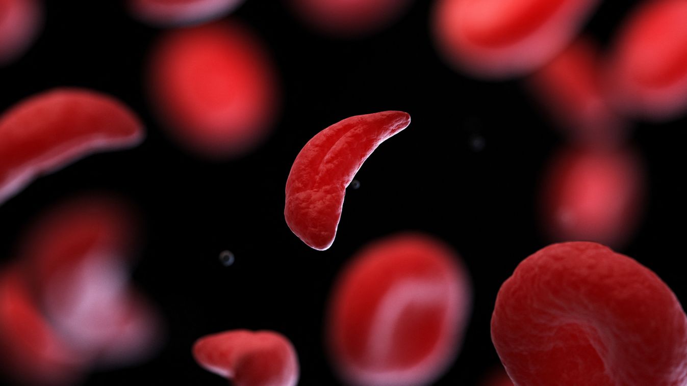 Sickle cell, illustration