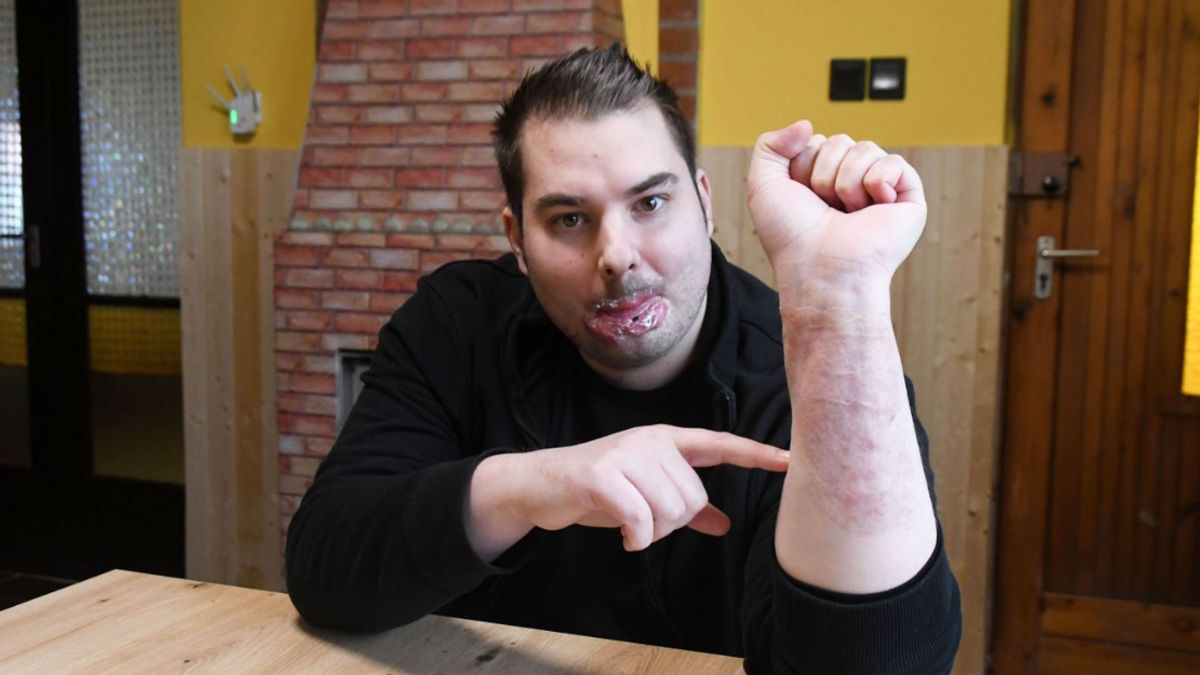 Bige László cége magára hagyta életveszélyesen megsérült munkását