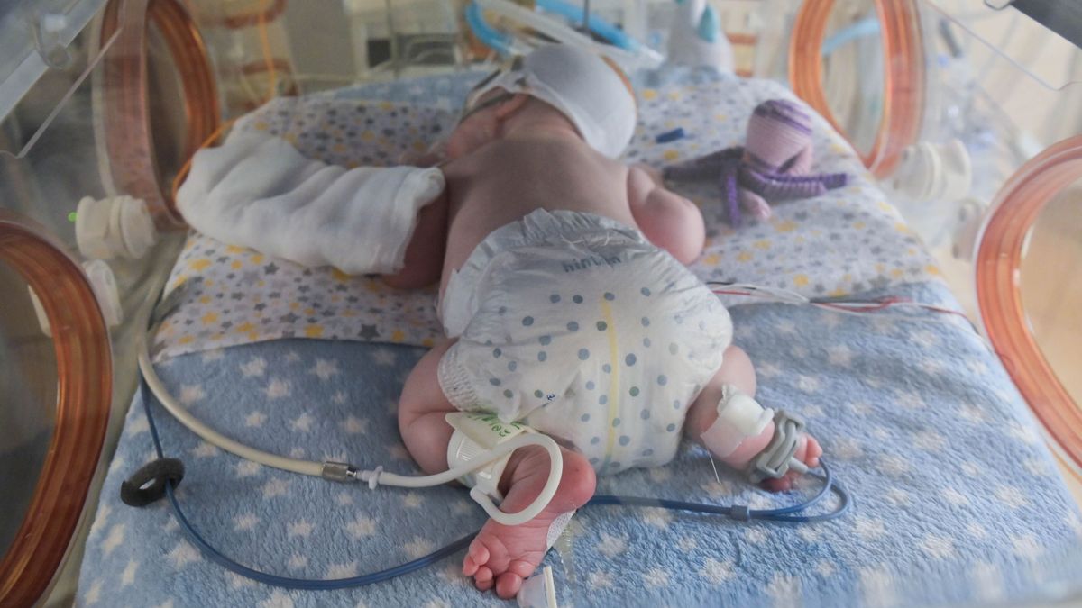 Már nyolc újszülöttnél alkalmazták sikeresen a műtüdőkezelést