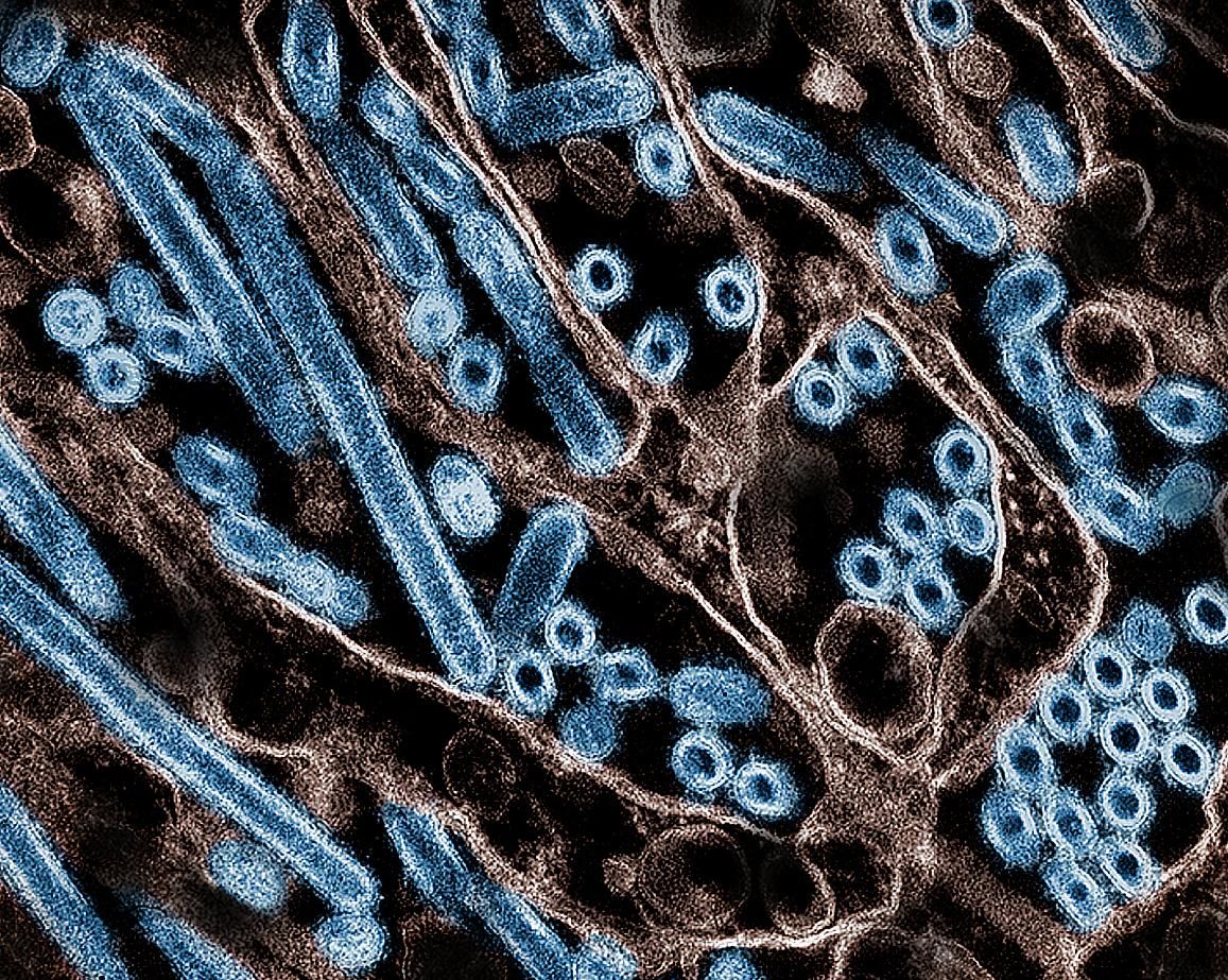 Hámsejtekben tenyésztett madárinfluenza. A H5N1 vírusrészecskék (kék) színezett transzmissziós elektronmikroszkópos felvétele látható.