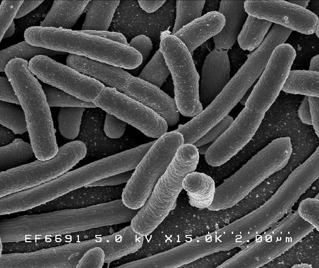 A vastagbélrák fiatalabb korosztályokban való megnövekedésének hátterében az E. coli baktérium termelte toxin állhat