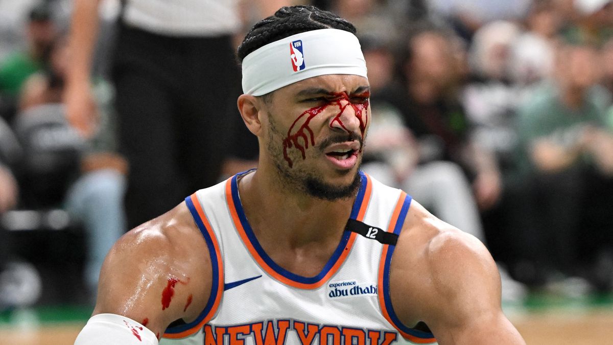 Hiába ontotta vérét a New York játékosa, így is életben maradt az NBA bajnoka + videó