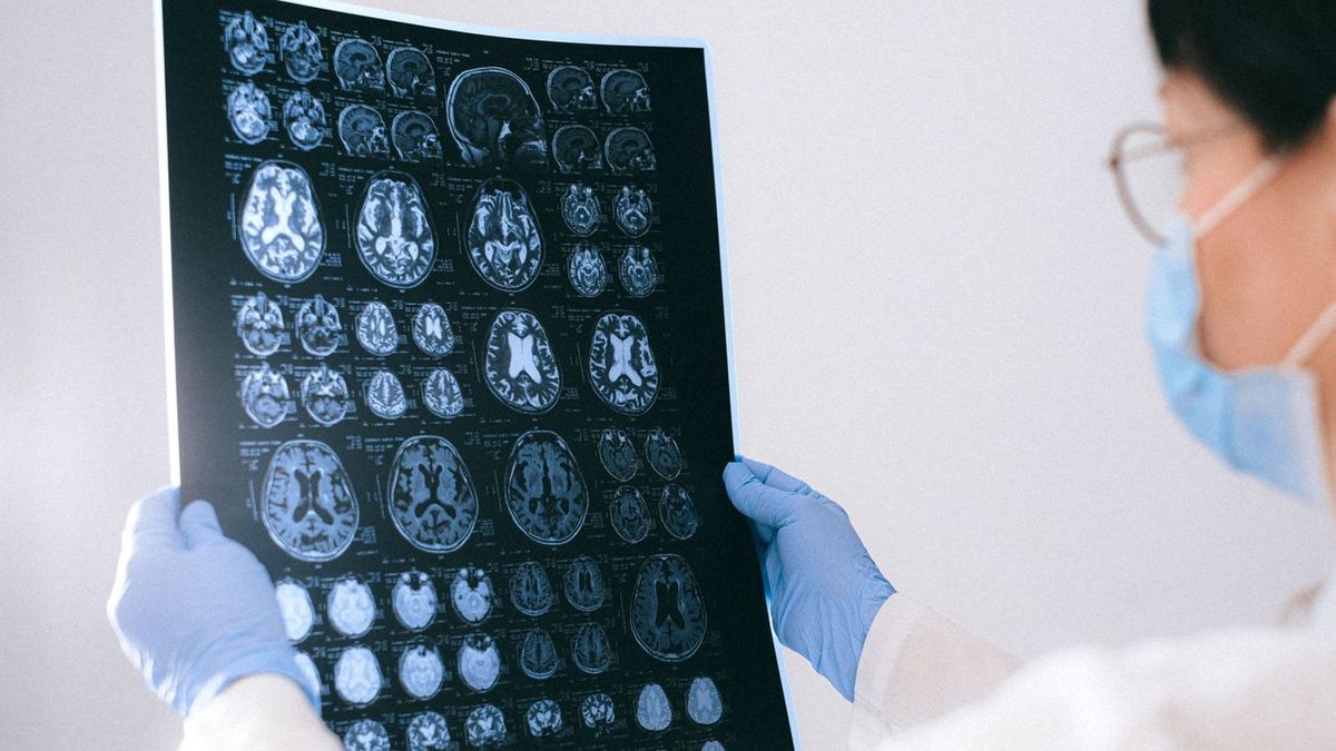 Ez a szuperélelmiszer segíthet a Parkinson-kór megelőzésében