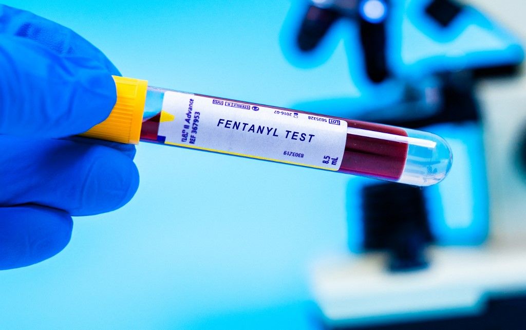 Fentanyl blood lab test. Screens for fentanyl, a synthetic opioid pain reliever, significantly more potent than morphine. (Photo by Wladimir Bulgar/Science Photo Li / WBU / Science Photo Library via AFP)