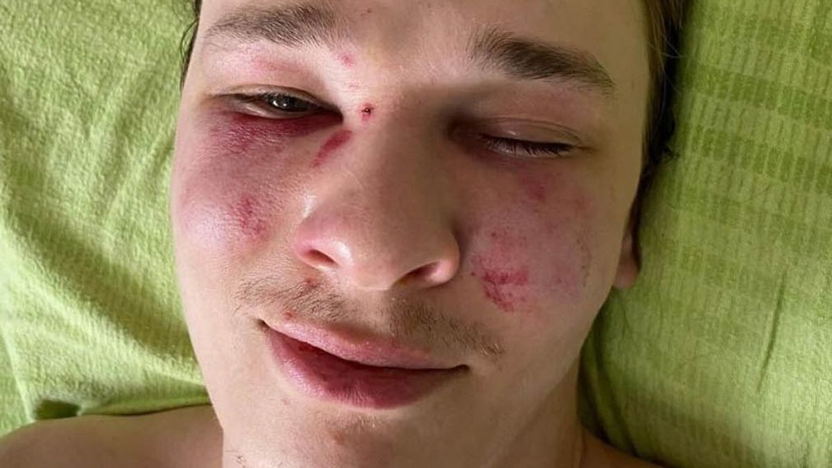 Az ukrán hatóságok szerint saját magát verte meg egy fiú a kényszersorozás során  - videó