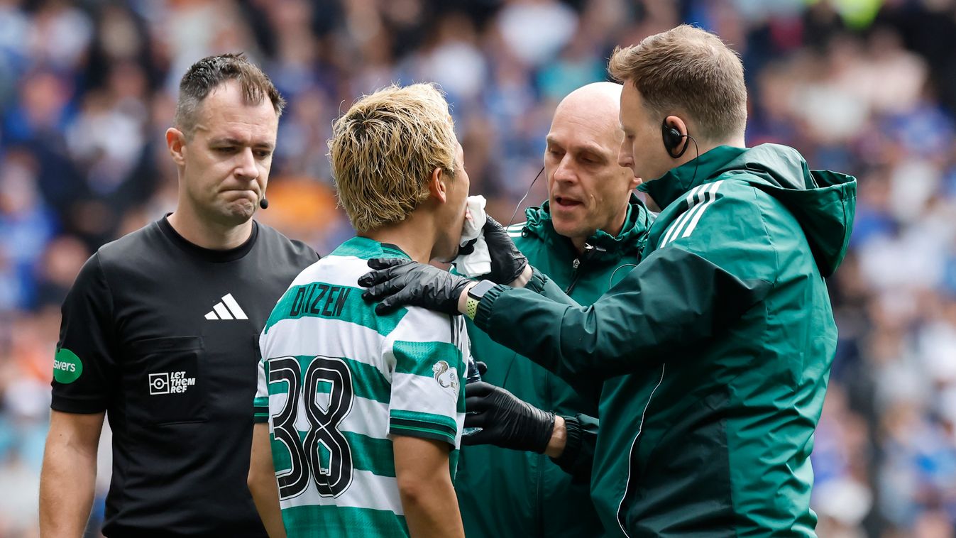 Daizen Maeda (Celtic) megszenvedte a Rangers elleni rangadót, az FTC El-ellenfele nem tudott nyerni