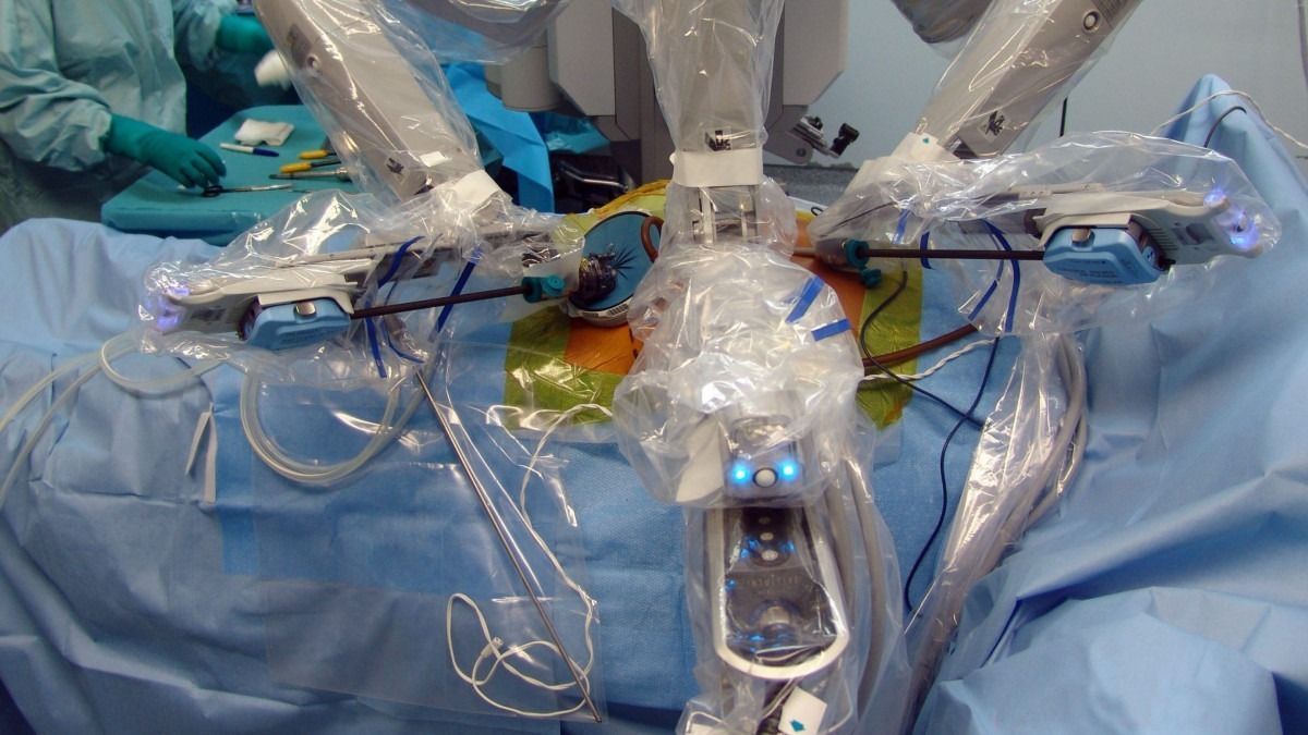 Elvégezték az ezredik robot-mellkassebészeti beavatkozást az Országos Onkológiai Intézetben