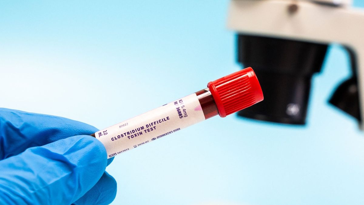 Első világháborús betegség jelent meg Ukrajnában