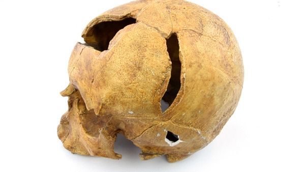 Macsói Béla koponyája. forrás: MTT Múzeum blog.