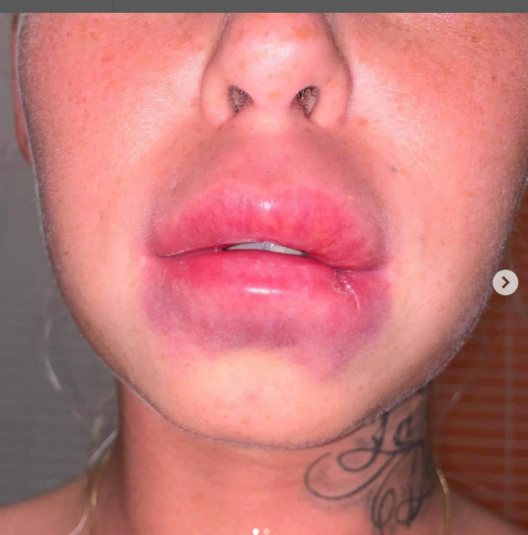 illegális esztétikai beavatkozások