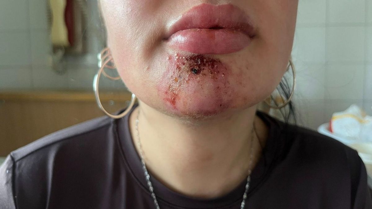 illegális esztétikai beavatkozások