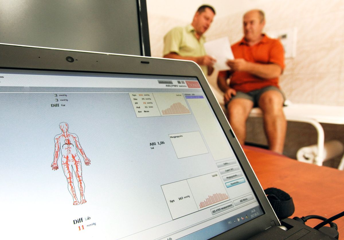 Debrecen, 2017. augusztus 31.
Köbling Tamás (b) szakorvos, az elsők között érkezett Kocsis Sándor Miklóssal beszéli meg az új beszerzésű BOSO készülék vizsgálati eredményét. A Debreceni Egyetem Klinikai Központjában új vizsgáló berendezés használatát kezdték meg, amivel 5-10 perc alatt végtagi érszűkület diagnosztikát végeznek gyorsabban, precízebben. A BOSO ABI-rendszerrel a két karon és lábon egyszerre lehet a vizsgálatot elvégezni. Az első napon több százan érdeklődtek és regisztráltak. 
MTVA/Bizományosi: Oláh Tibor 
***************************
Kedves Felhasználó!
Ez a fotó nem a Duna Médiaszolgáltató Zrt./MTI által készített és kiadott fényképfelvétel, így harmadik személy által támasztott bárminemű – különösen szerzői jogi, szomszédos jogi és személyiségi jogi – igényért a fotó készítője közvetlenül maga áll helyt, az MTVA felelőssége e körben kizárt.