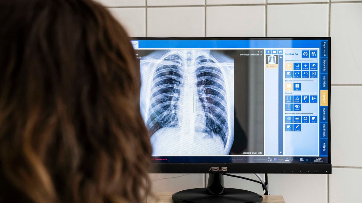 TBC-s lett egy tanár Csongrádban, már vizsgálják a kontaktokat