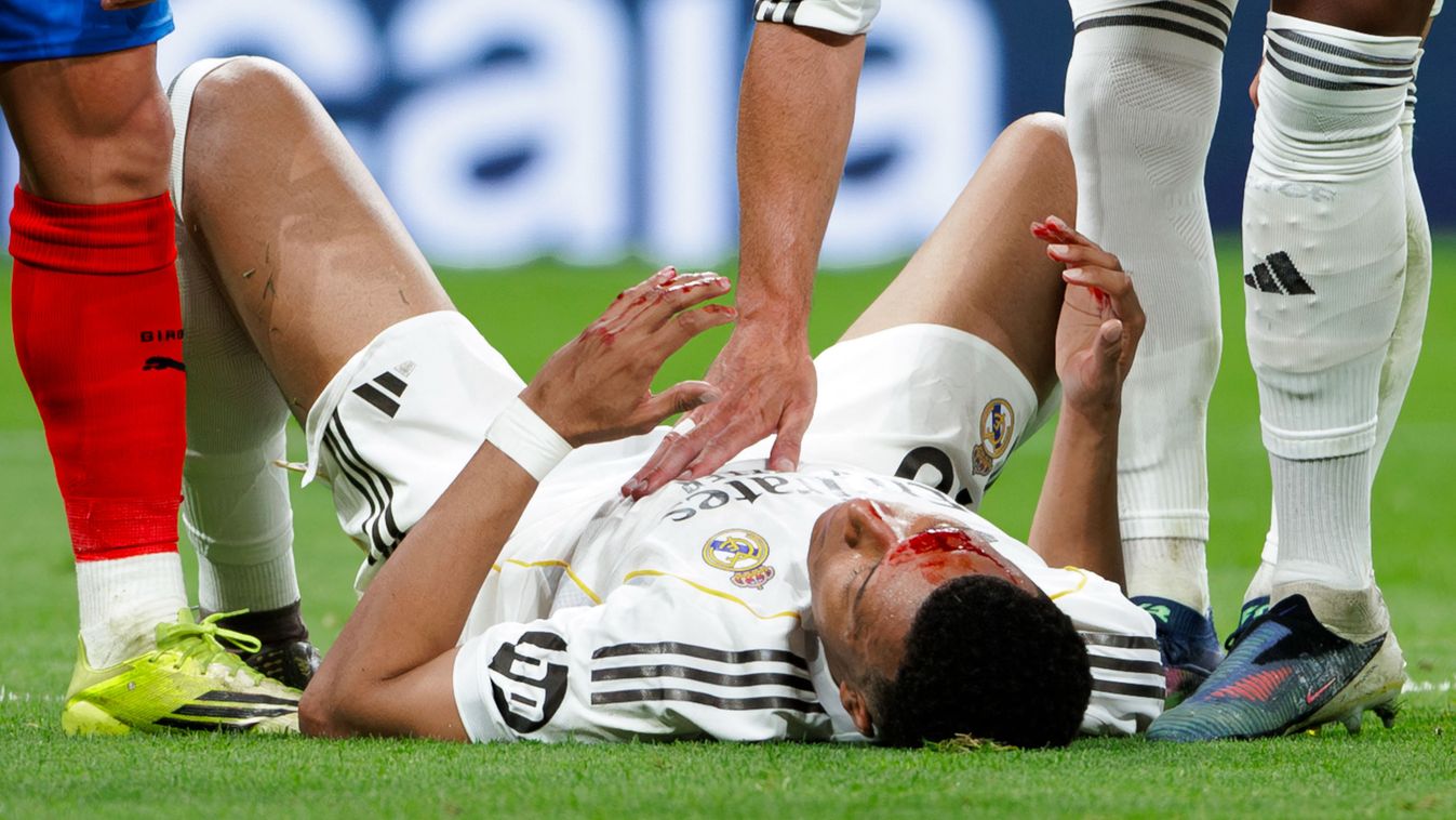 Mbappé
Kylian Mbappe of Real Madrid is injured during the La Liga 2025/26 match between Real Madrid and Girona at Santiago Bernabeu Stadium in Madrid, Spain, on April 10, 2026. (Photo by Guillermo Martinez/NurPhoto) (Photo by Guillermo Martinez / NurPhoto