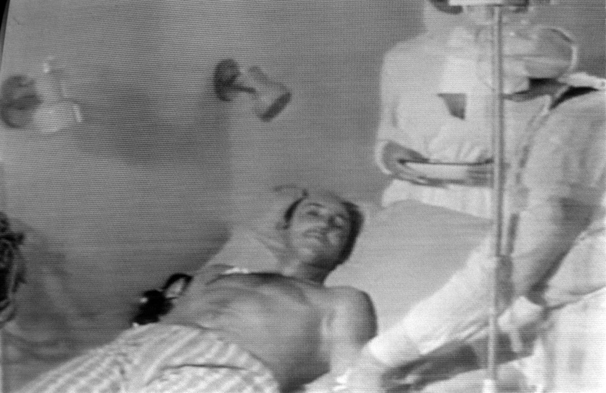 Undated picture sent by Soviet television of a man injured in the blast of No. 4 reactor of Ukrainian Chernobyl nuclear plant, the world's worst nuclear accident of the 20th century. (Photo by AFP)