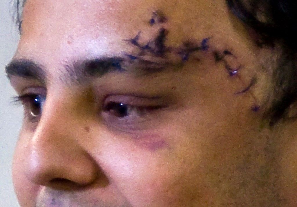 Brazilian Formula One driver Felipe Massa smiles at Albert Einstein Hospital in Sao Paulo on August 3, 2009. Massa arrived in his native Brazil late Monday, flying in from Hungary where he had surgery for serious head injuries sustained in a July25 racing accident. The 28-year-old landed at Sao Paulo airport on a private jet accompanied by wife Rafaela and his doctor, Dino Altman, airport officials told AFP, and was transferred to a waiting helicopter that flew him to the hospital. AFP PHOTO/Nelson ALMEIDA (Photo by Nelson ALMEIDA / AFP)